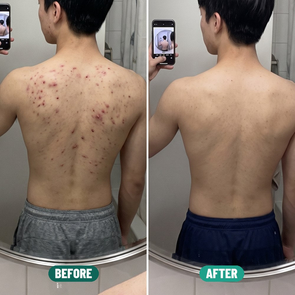 Ethan before and after