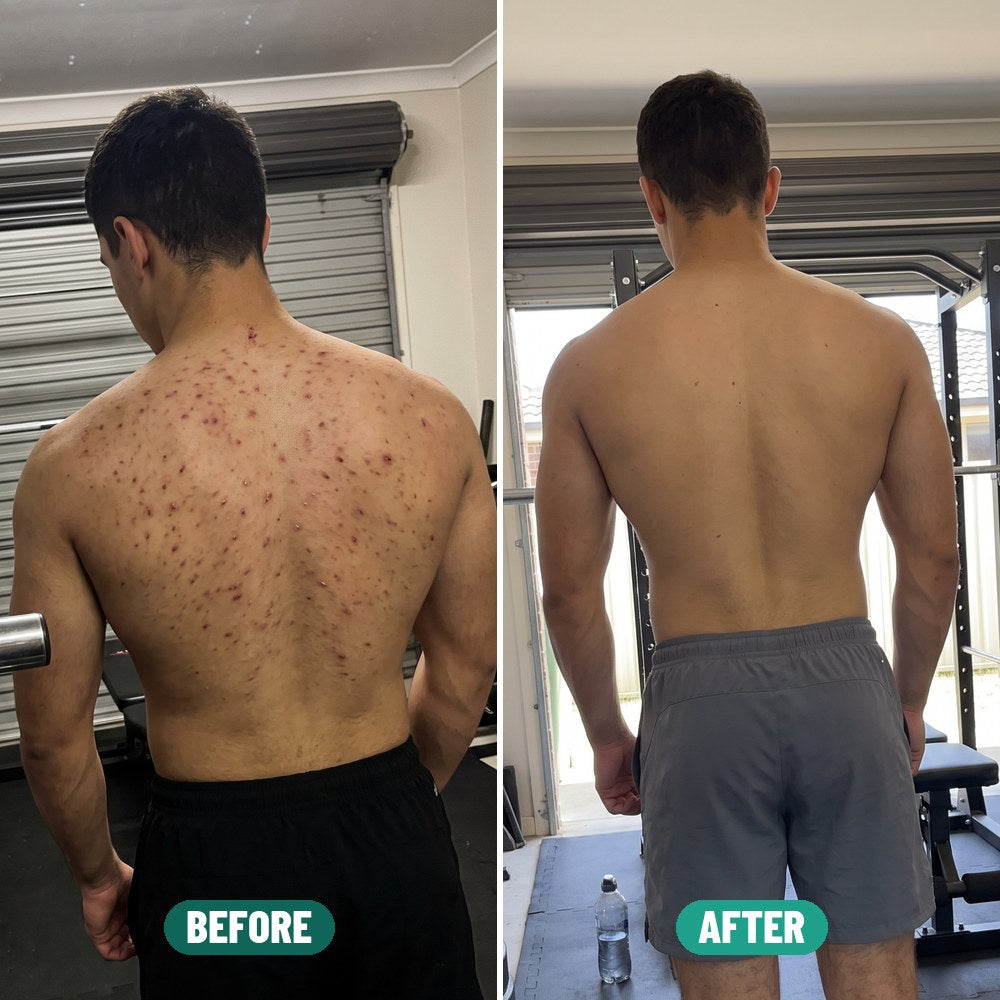 Nick before and after