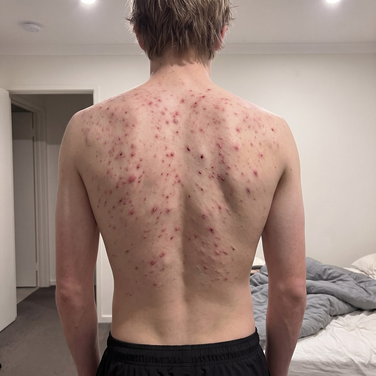 Lachy's back before Grom