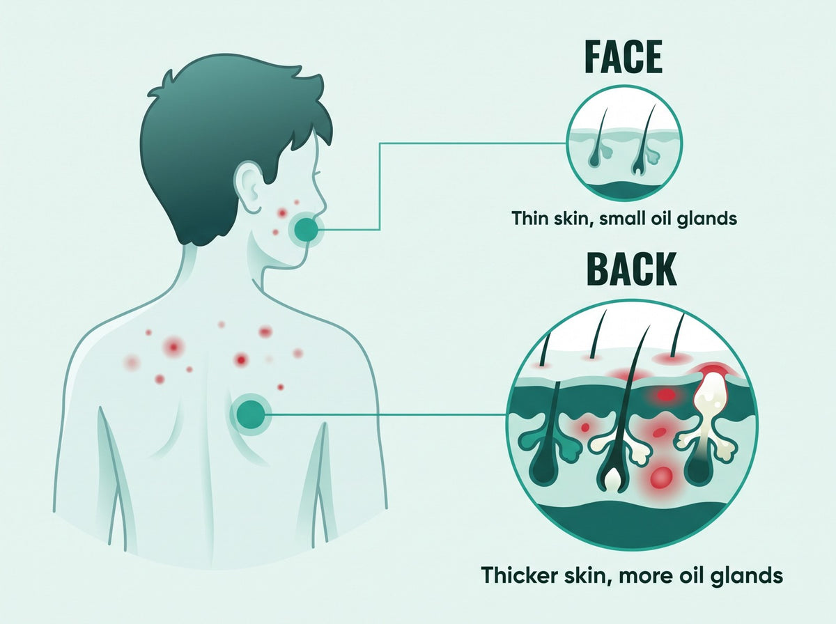 Face skin vs back skin: thicker skin and more oil glands on the back
