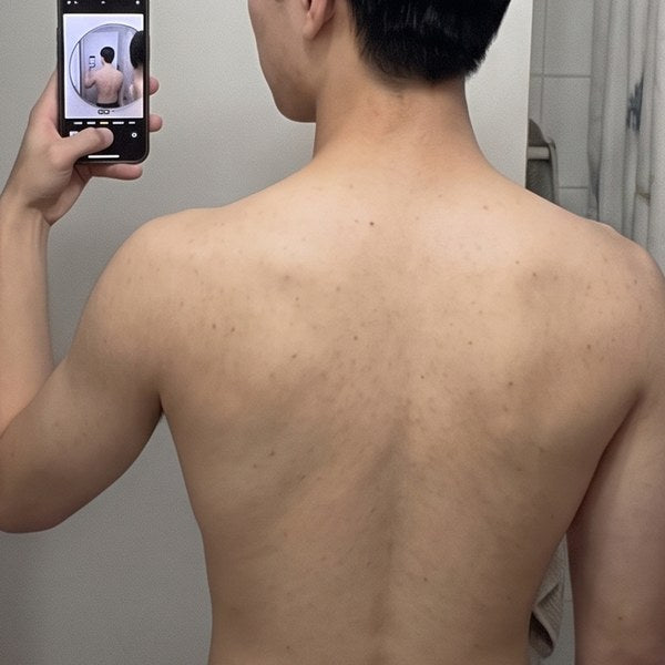 After