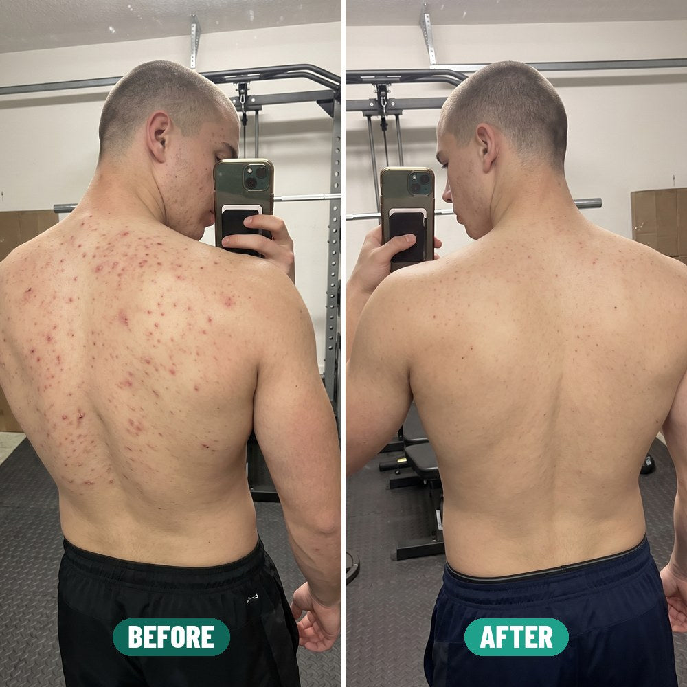 Aiden before and after