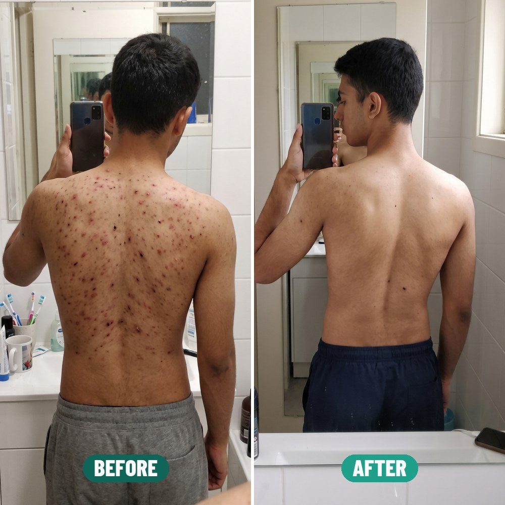 Dev before and after