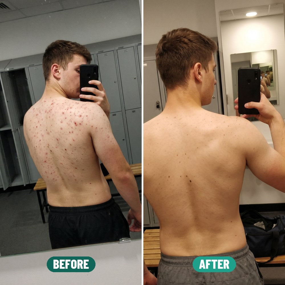 Josh before and after