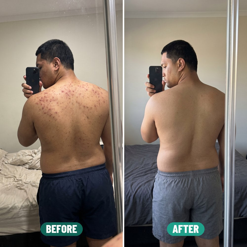 Kai before and after