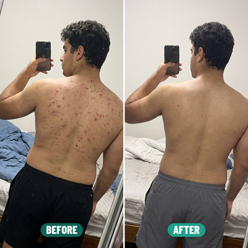 Matt before and after