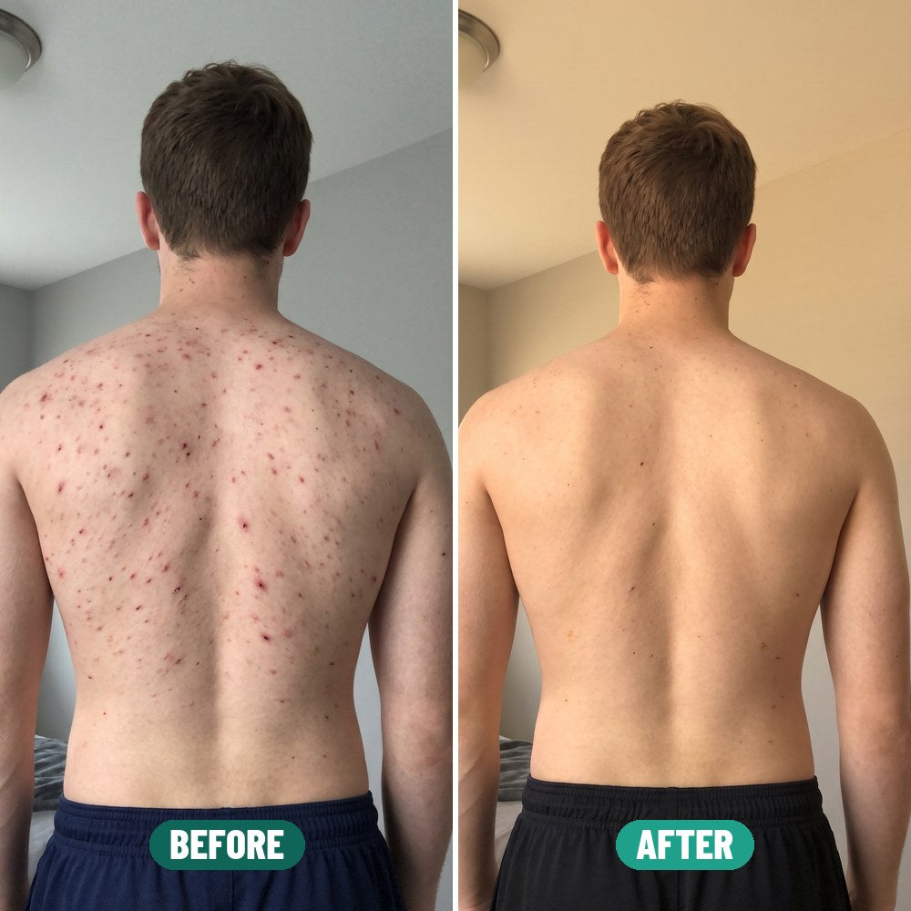 Riley before and after