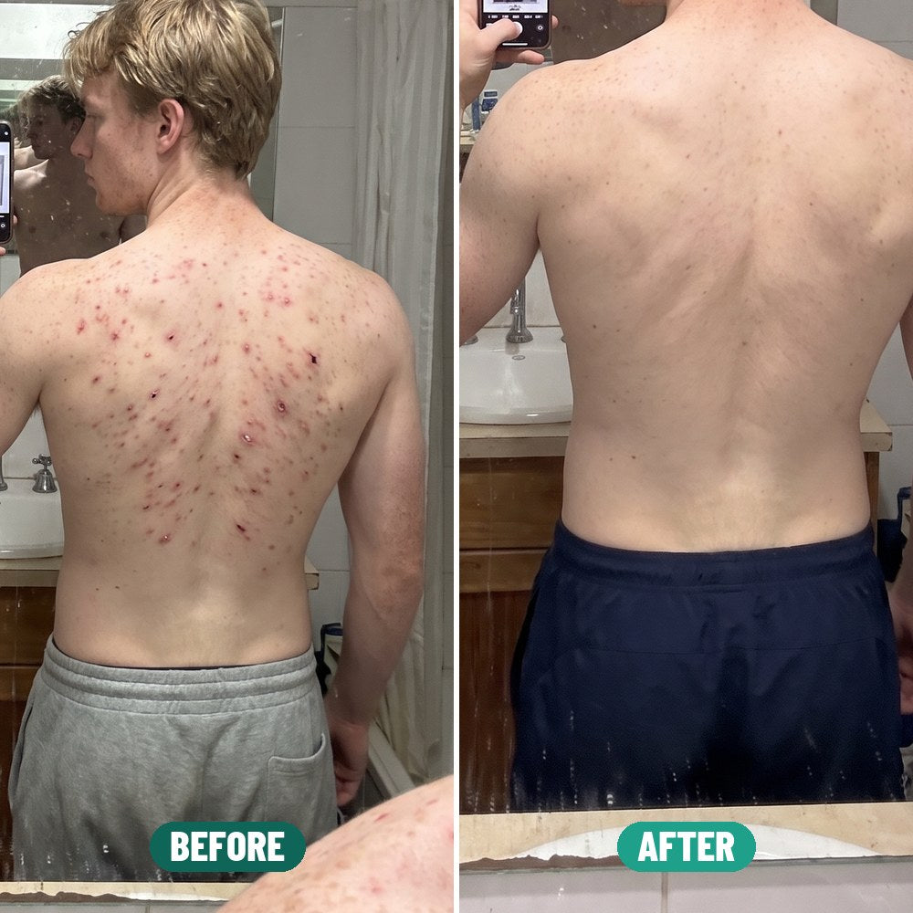Tom before and after